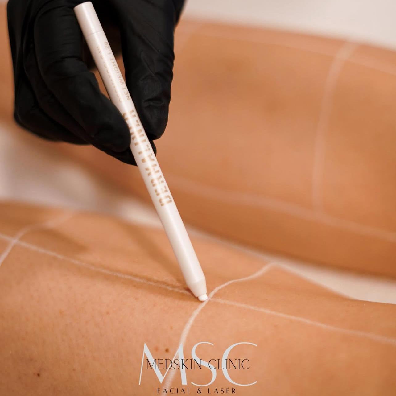 Dermaliner® witte huidmarker Maat S