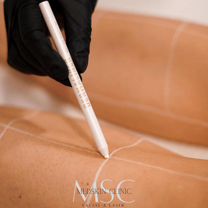 Dermaliner® witte huidmarker Maat S