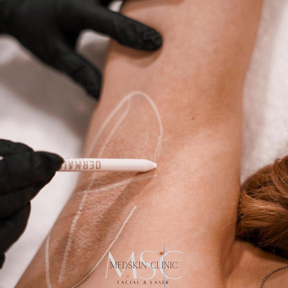 Dermaliner® witte huidmarker Maat S